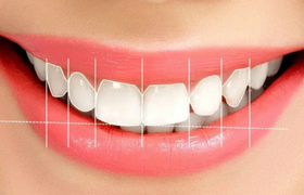 Dentmaster Elazığ Diş Beyazlatma