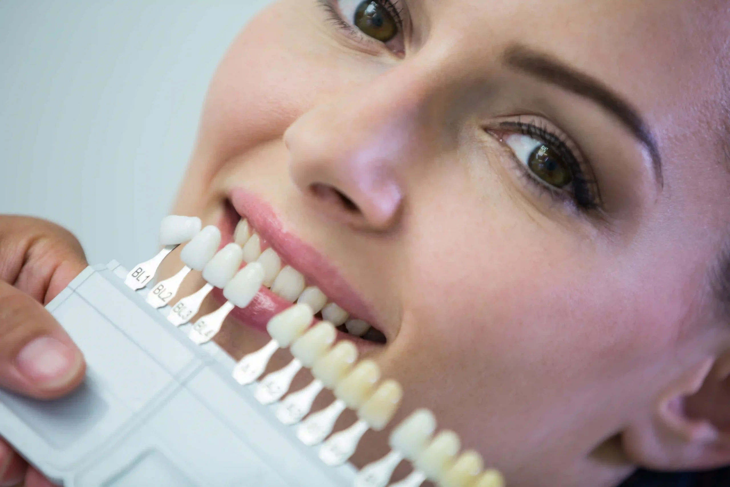 Zirkonyum Diş Kaplama Nedir? Avantajları ve Fiyatları