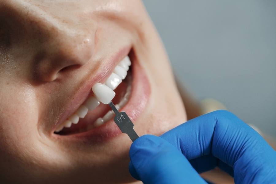 Restoratif Diş Tedavisi Nedir? Dentmaster ile Sağlıklı, Doğal ve Güçlü Gülüşler